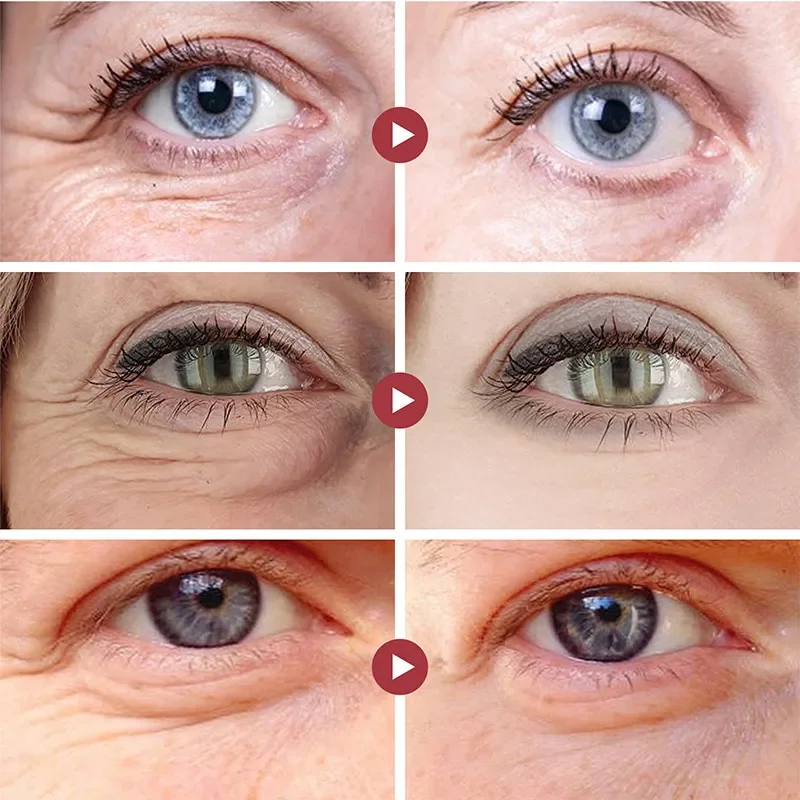 Wrinkle Remove Eyes Patches Fi - đánh giá và giá Sheet Mask Collagen